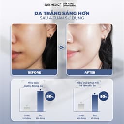 Thumbnail Kem Dưỡng Nâng Tông Trắng Da SUR.MEDIC Super Glutathione 100 Bright Tone Up Cream 40ml 3