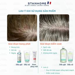 Thumbnail Combo viêm da đầu tiết bã Stanhome Balance Shampoo-Sos Cica-Gentle shampoo - Gentle Conditioner 2