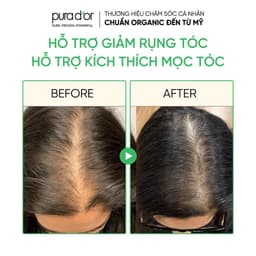 Thumbnail Tinh chất hữu cơ hỗ trợ mọc tóc, dày tóc Pura D'or Hair Therapy Energizing Scalp Serum 120ml 4
