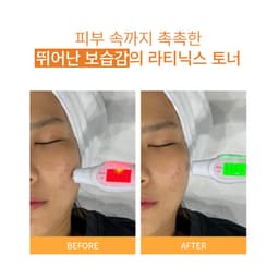 Thumbnail Toner Vitamin C Phục Hồi Nâng Tông Làm Trắng Da Lateenix Toner 100ml 4