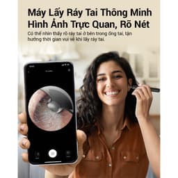 Thumbnail Dụng Cụ Lấy Ráy Tai Bebird X0 4