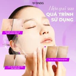 Thumbnail Combo 10 Mặt Nạ BNBG Tinh Chất Hỗ Trợ Tăng Cường EXOSOME Hỗ Trợ Giảm Lão Hóa 30mlx10 2