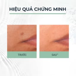 Thumbnail Tinh chất giảm thâm & dưỡng sáng cho da mụn Eucerin Pro Acne Triple Effect Serum 40ml 4
