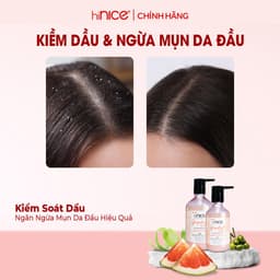 Thumbnail Dây Dầu Gội Tinh Dầu Bưởi Hồng Và Olive hiNICE Grapefruit & Olive Shampoo Hỗ Trợ Giảm Mụn Da Đầu 4