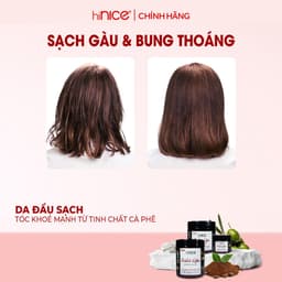 Thumbnail Kem Massage Da Đầu hiNICE Giúp Làm Sạch Vảy Gàu, Dưỡng Ẩm Và Giảm Mụn Da Đầu 4
