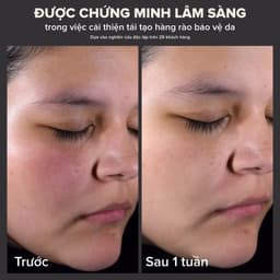 Thumbnail Dung dịch loại bỏ tế bào chết Paula's Choice 2% BHA 30ml 2