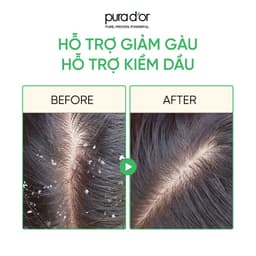 Thumbnail Dầu Gội Hỗ Trợ Giảm Gàu, Dưỡng Tóc Chắc Khoẻ Scalp Therapy Organic Pura Dor 473ml 4