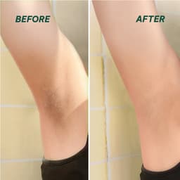 Thumbnail Peel da giúp làm sáng, giảm thâm mông, nách, bikini, đầu gối, khuỷu tay AHA 25% BareSoul Glowy Body Peel 50g 3