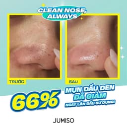 Thumbnail Tinh chất ủ mụn đầu đen Jumiso Blackhead Melting Softener Special Kit 150ml làm sạch bã nhờn và mụn đầu đen hiệu quả 2