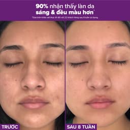 Thumbnail Tinh chất se khít lỗ chân lông tối ưu Paulas Choice Niacinamide 20% Treatment 2ml 78032.1 2