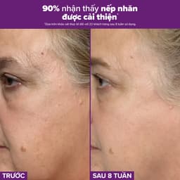 Thumbnail Tinh chất se khít lỗ chân lông tối ưu Paulas Choice Niacinamide 20% Treatment 2ml 78032.1 3