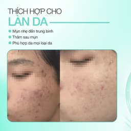 Thumbnail Dung Dịch Peel Trẻ Hóa, Căng Bóng Da Và Ngừa Mụn Luminclear Perfection Peel Solution 2ml 3