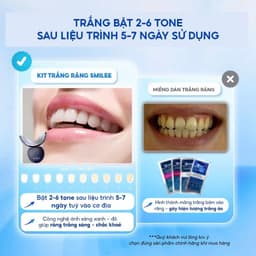 Thumbnail Trắng răng Smilee Extra, trắng răng từ 2-6 tone sau một liệu trình. Hàng chính hãng 4