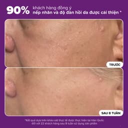 Thumbnail Tinh chất se khít lỗ chân lông và làm mờ thâm mụn Paula's Choice Niacinamide 20% Treatment 20ml 8030 3