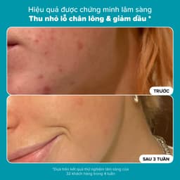Thumbnail Dung dịch loại bỏ tế bào chết Paula's Choice Skin Perfecting 2% BHA Liquid Exfoliant 30ml - 2016 3