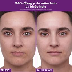 Thumbnail Tinh chất làm mờ nám và nếp nhăn Paula’s Choice Clinical 1% Retinol Treatment 30 ml 8010 4