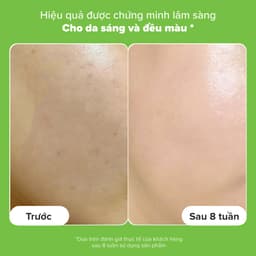 Thumbnail Tinh chất thu nhỏ lỗ chân lông Paula's Choice 10% Niacinamide Booster 20ml mã 7980 3