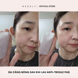 Thumbnail Toner Pad Needly Anti-Trouble Làm Sạch Bã Nhờn Căng Bóng 250G 60 Miếng & Túi Refill Daily Toner Pad 1