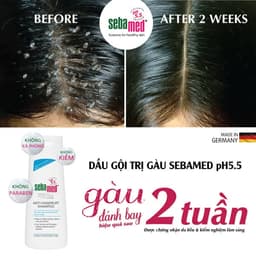 Thumbnail Dầu gội giúp giảm gàu Sebamed Hair Care Anti-Dandruff Shampoo pH5.5 (200ml) 2