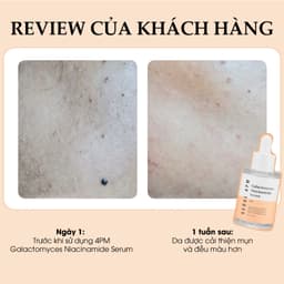 Thumbnail Tinh Chất Dưỡng Sáng, Tăng Cường Hàng Rào Bảo Vệ Da 10% Galactomyces +10% Niacinamide 4PM Galactomyces Niacinamide Serum 4