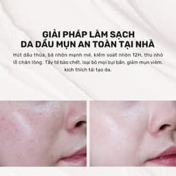 Thumbnail (KOL) Mặt Nạ Đất Sét Hút Dầu Kiểm Soát Nhờn 12H Derladie Vegan Pink Clay Mask Deep Pore Tightening 2
