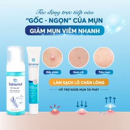 Thumbnail Combo Giảm mụn nhanh Kem Chấm Mụn Viêm 20gr & Bọt Rửa Mặt Sạch Sâu, Ngừa Mụn 150ml [TẶNG NTT 50ML] 1