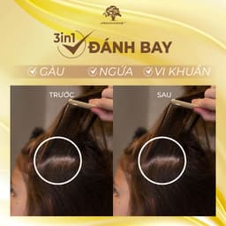 Thumbnail Combo Dầu gội sạch gàu Arganmidas và xả siêu dưỡng ẩm Collagen Giảm rụng tóc, ngứa, chắc khỏe chân tóc 450ml 4