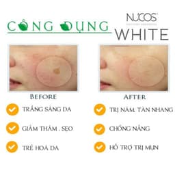Thumbnail Viên uống trắng da nhật bản NUCOS giúp làm sáng, đều màu da mờ thâm nám, chống oxy hóa 60 viên 3
