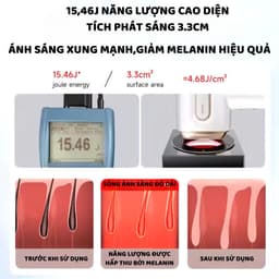 Thumbnail Máy triệt lông ENZO cao cấp, công nghệ IPL giảm thâm trẻ hóa da, triệt lạnh ICE, Bảo Hành 10 Năm 3