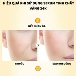 Thumbnail Tinh chất Serum ENZO, Serum trắng da dưỡng ẩm chống lão hóa da, 100ML 4
