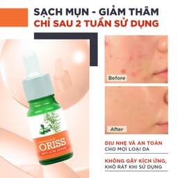 Thumbnail Serum giảm mụn Oriss tinh chất tràm trà hỗ trợ mờ thâm sạch mụn 10g 2