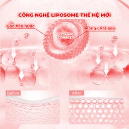 Thumbnail Combo 10 Mặt Nạ BNBG Hỗ Trợ Nâng Cơ, Săn Chắc Da BNBG Vita Genic Lifting Jelly Mask 30mlx10 4
