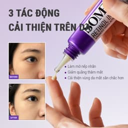Thumbnail Kem dưỡng mắt Some By Mi Retinol 0.1% Intense Advanced Triple Action Eye Cream 30ml giảm quầng thâm và nếp nhăn 3