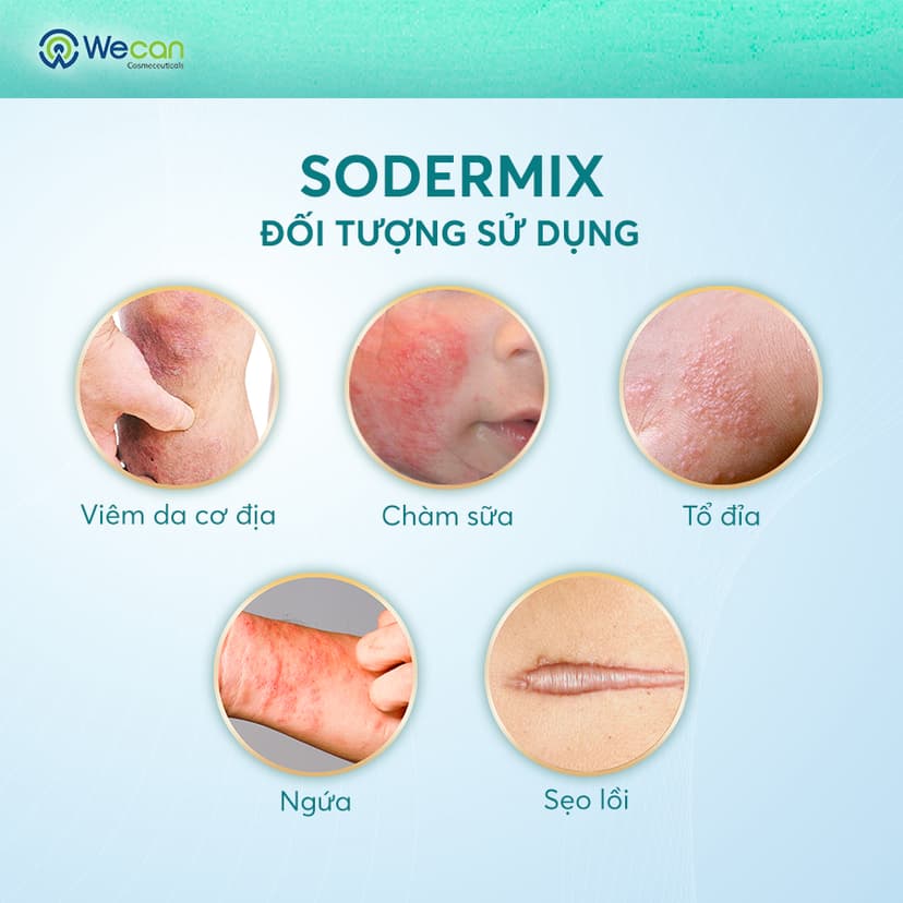 Ảnh 2 SODERMIX 15g - Tặng Kem Helia - Kem Bôi Viêm Da Cơ Địa Hỗ Trợ Ngứa Ngáy, Eczema, Chàm Sữa, Tổ Đỉa, Dưỡng Ẩm 3