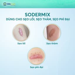 Thumbnail Kem Bôi Sẹo Lồi, Sẹo Phì Đại - SODERMIX - Hỗ Trợ Làm Xẹp Sẹo Lồi, Sẹo Phì Đại, Mờ Sẹo Thâm - Nhập Từ Pháp 2