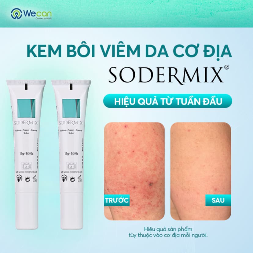 Ảnh 2 SODERMIX 15g - Tặng Kem Helia - Kem Bôi Viêm Da Cơ Địa Hỗ Trợ Ngứa Ngáy, Eczema, Chàm Sữa, Tổ Đỉa, Dưỡng Ẩm 1